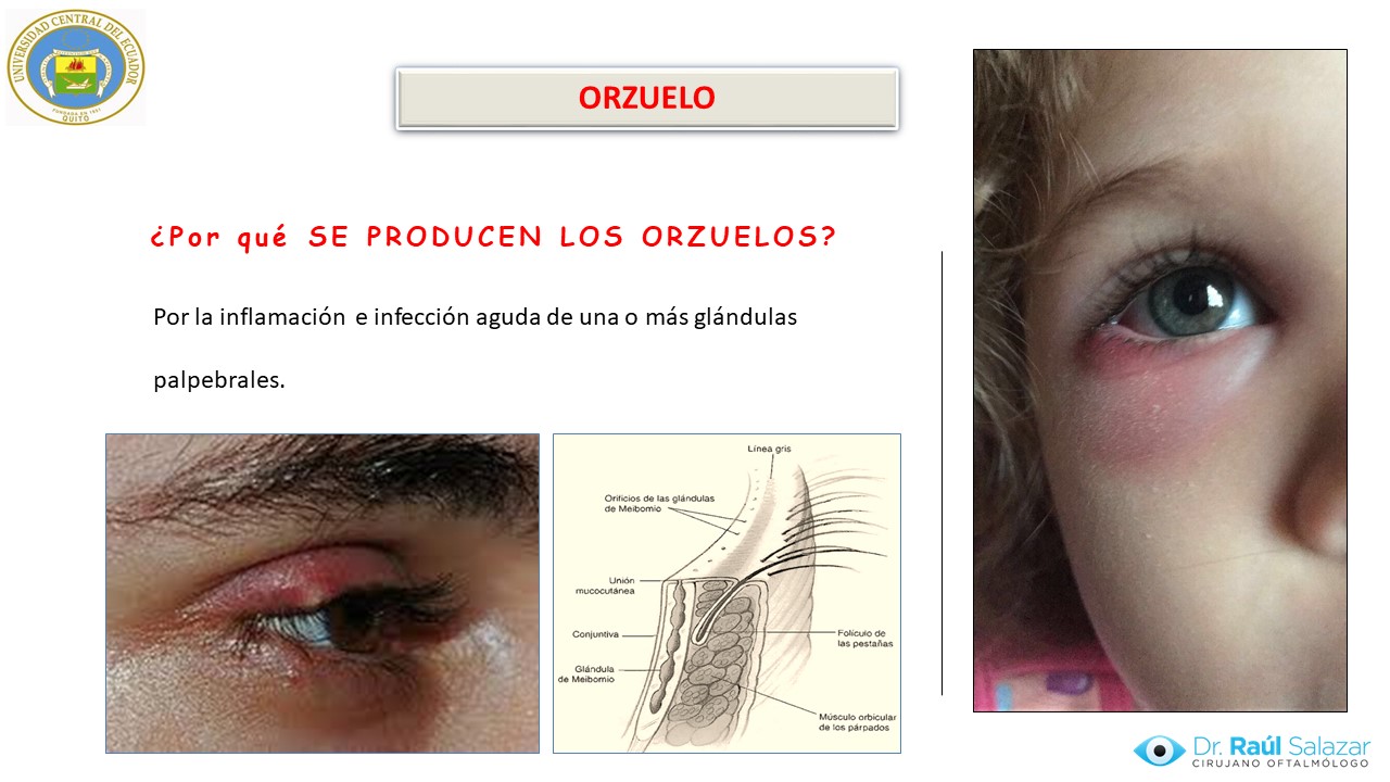 Diapositiva65