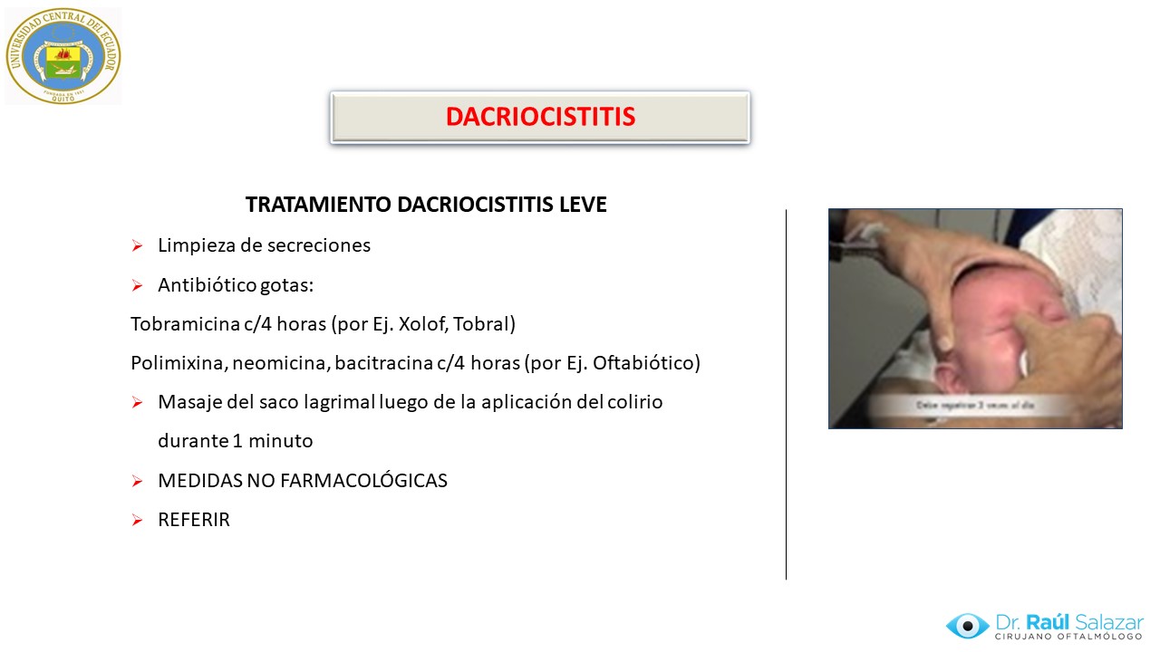 Diapositiva72
