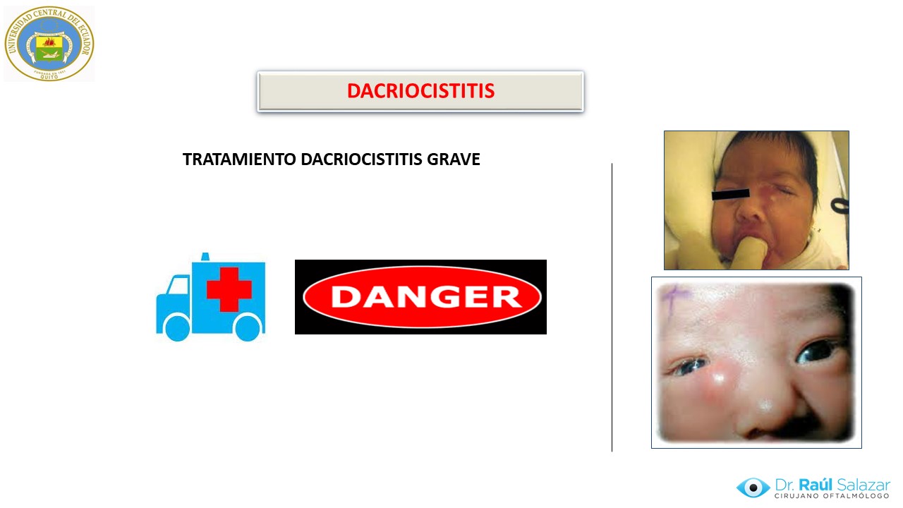 Diapositiva73