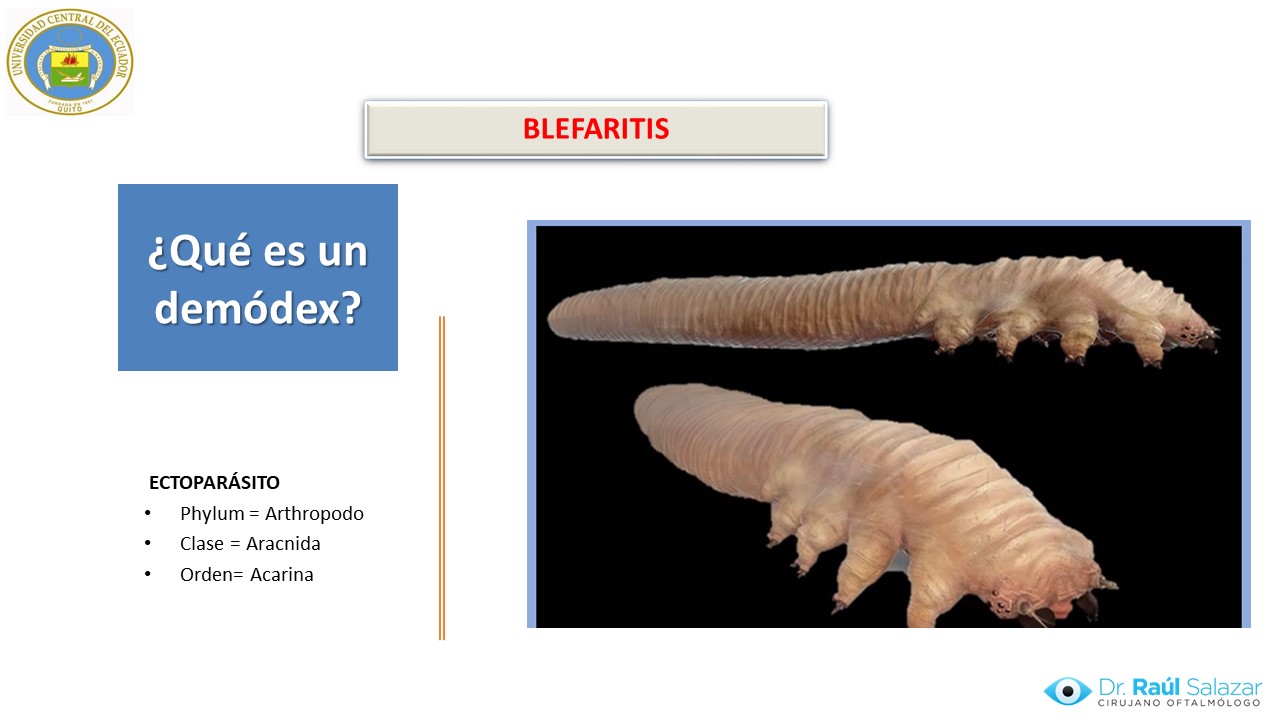 Diapositiva77