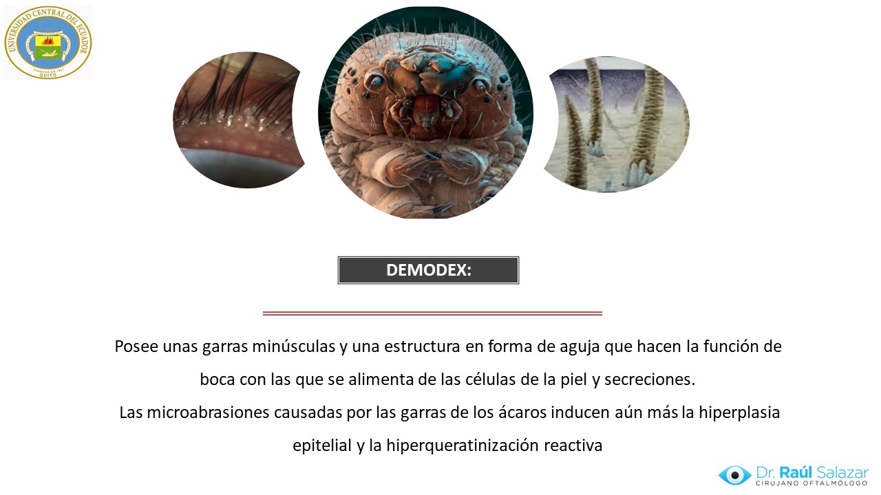 Diapositiva83