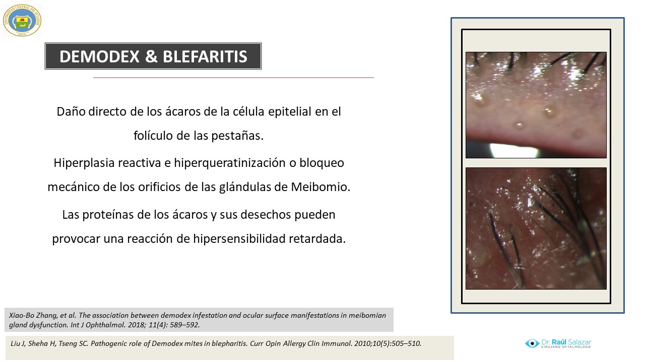 Diapositiva85