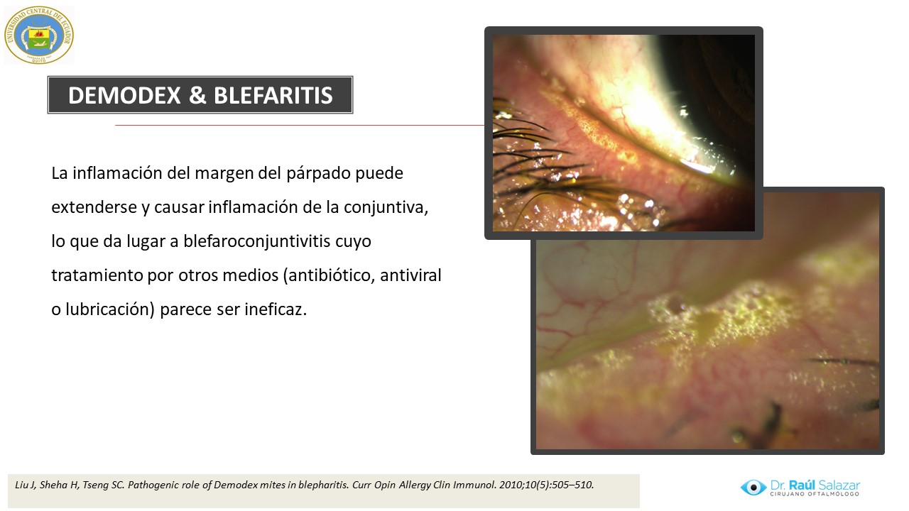 Diapositiva87
