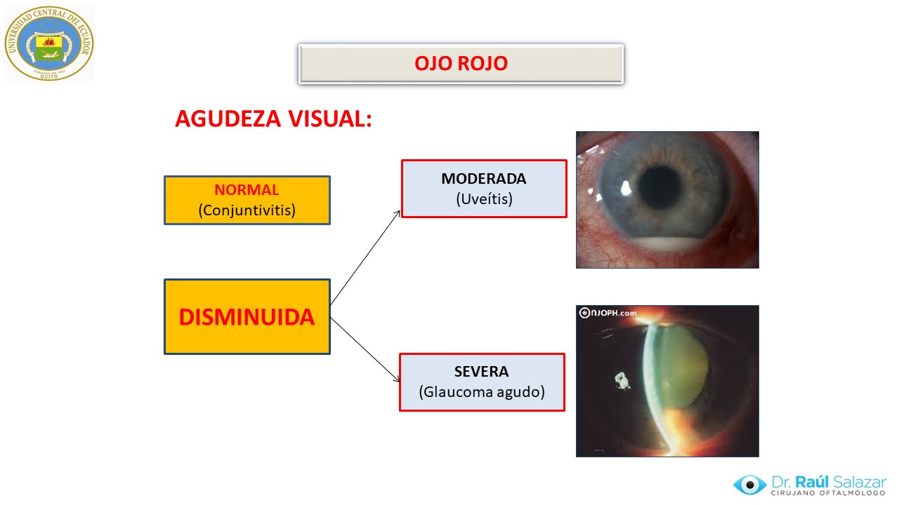 Diapositiva9