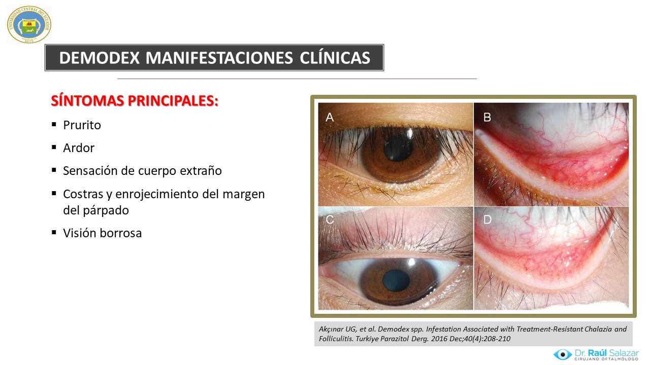Diapositiva91