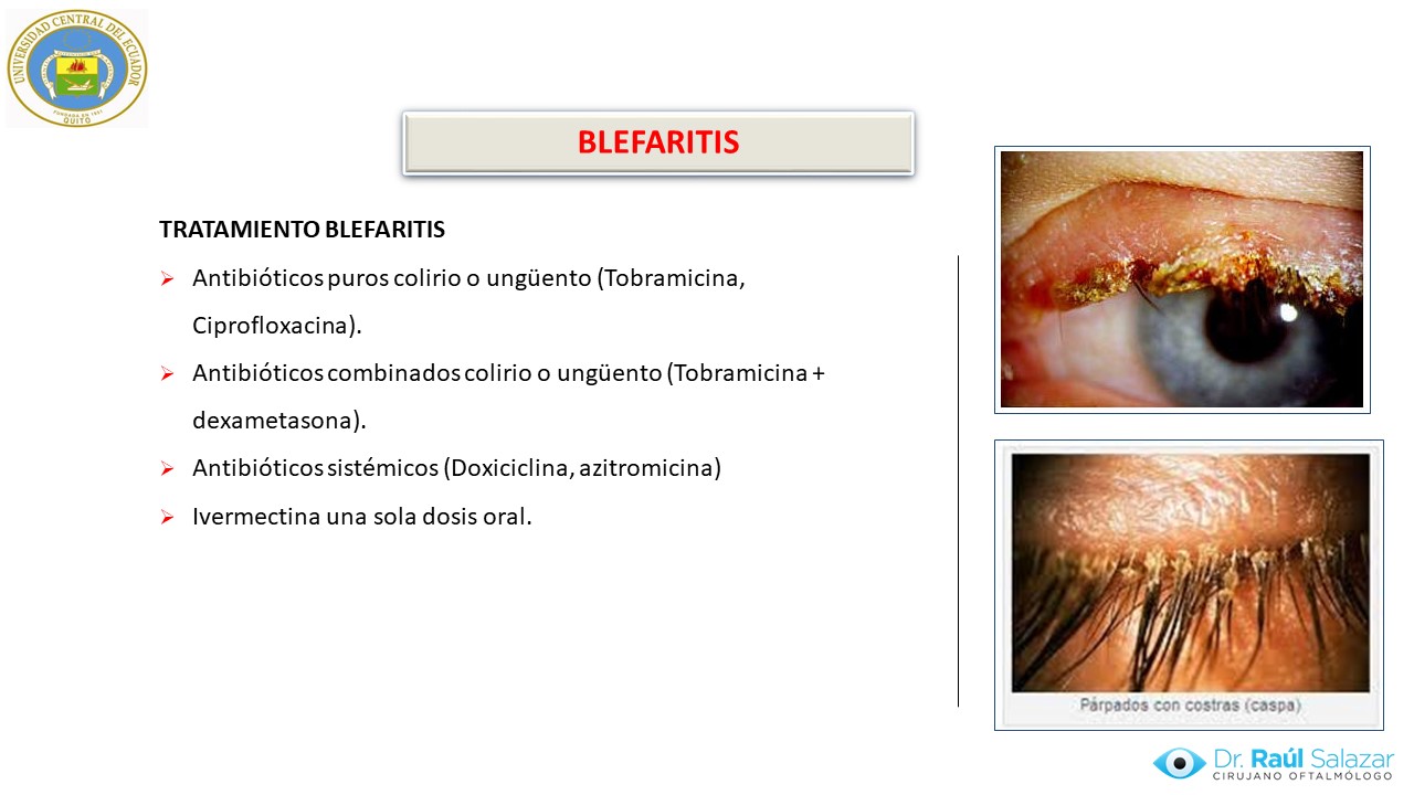 Diapositiva98