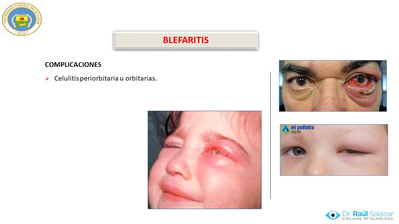 Diapositiva99