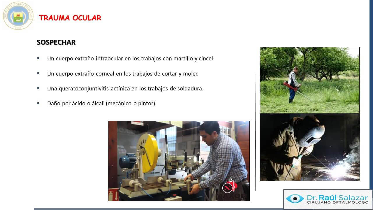 TRAUMA-OCULAR-Diapositiva11