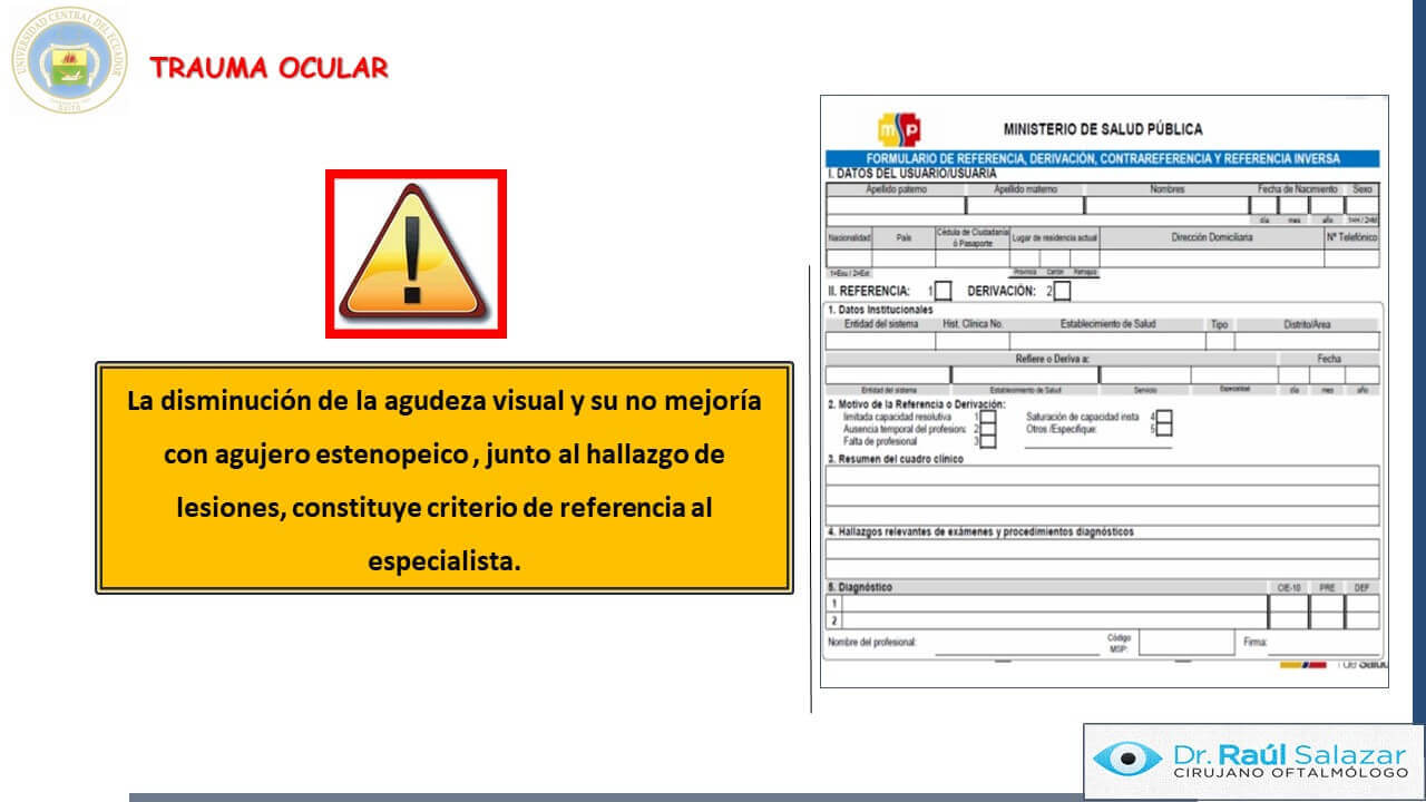 TRAUMA-OCULAR-Diapositiva14
