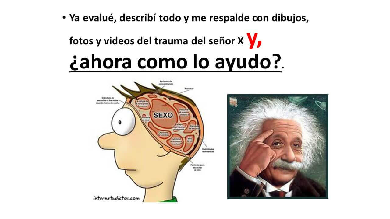 TRAUMA-OCULAR-Diapositiva19