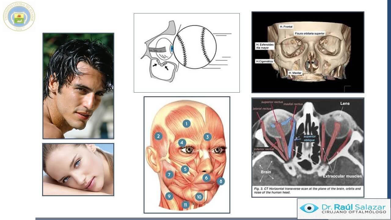 TRAUMA-OCULAR-Diapositiva2