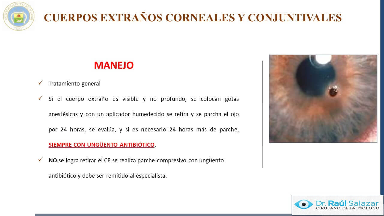 TRAUMA-OCULAR-Diapositiva38