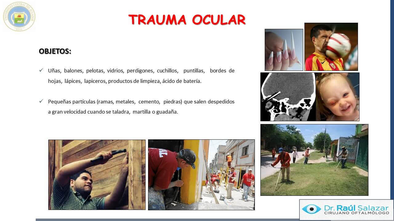 TRAUMA-OCULAR-Diapositiva5