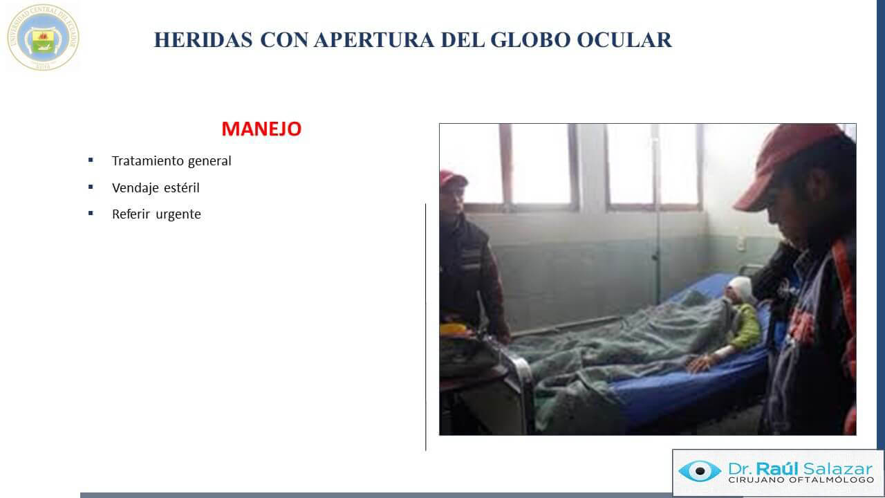 TRAUMA-OCULAR-Diapositiva54