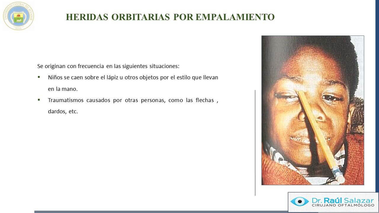 TRAUMA-OCULAR-Diapositiva56