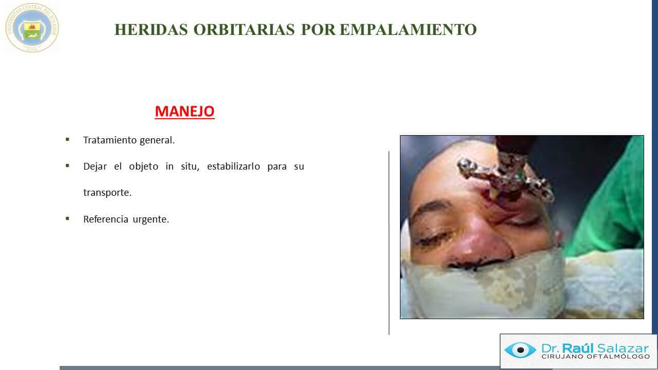 TRAUMA-OCULAR-Diapositiva57