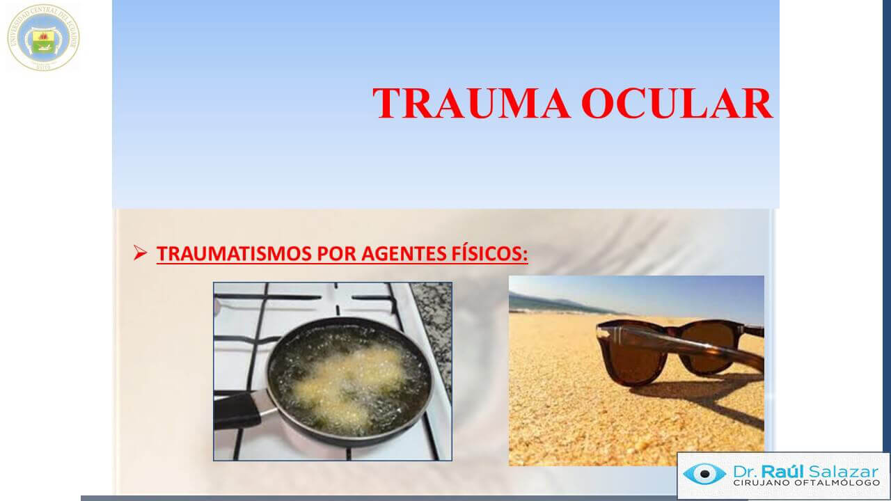 TRAUMA-OCULAR-Diapositiva65