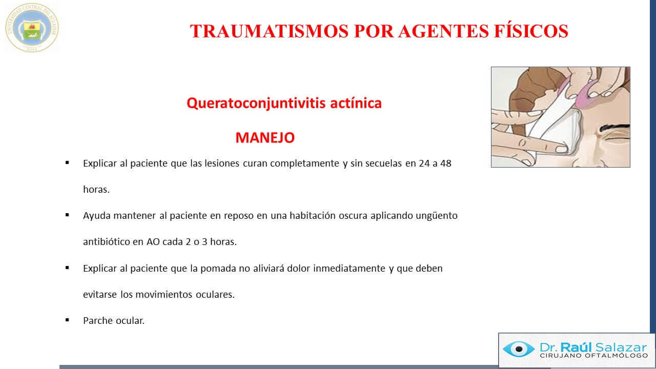 TRAUMA-OCULAR-Diapositiva68